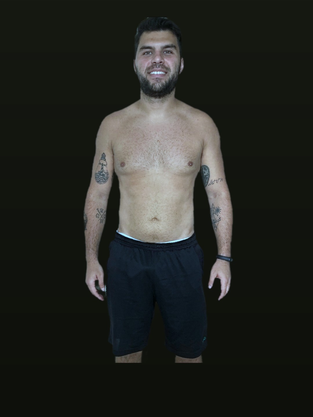 Douglas depois da transformação, de frente